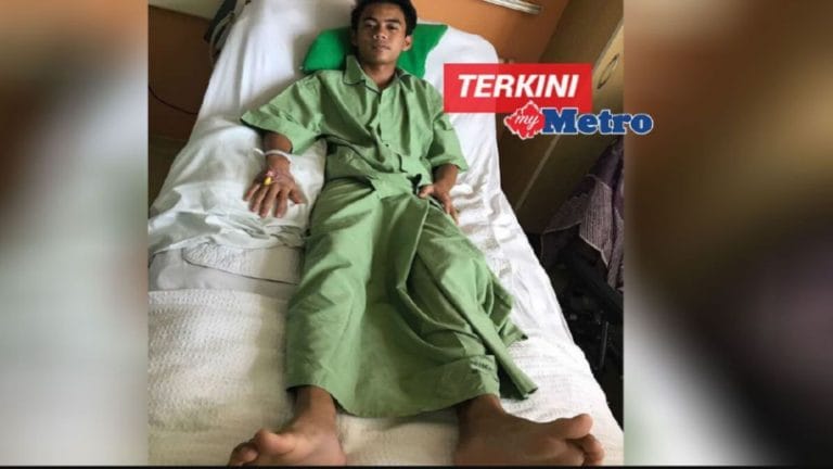 Otot peha koyak dan tisu rosak selepas didenda guru