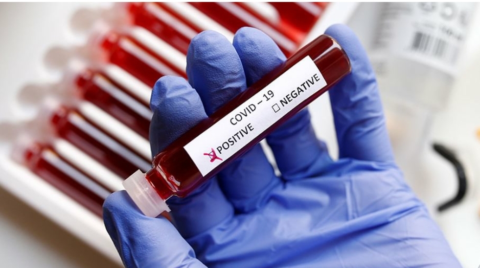 STATISTIK TERKINI COVID-19 MALAYSIA